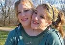 Conjoined Twins, One Love Life: The Questions Keep Getting Weirder
