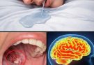 If you drool while sleeping, you should get checked for these 8 conditions…See more